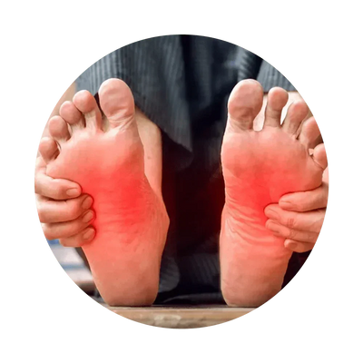 Neuropatía
